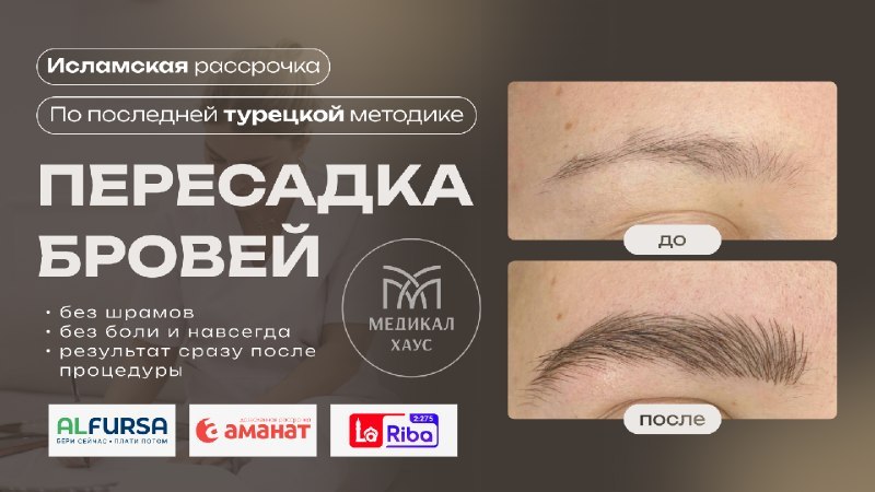 @peresadkavolos_medicalhouse